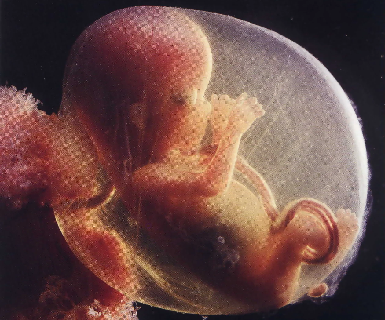 Шестнадцати недель. Эмбрион на 16 неделе беременности. Эмбрион на 17 неделе беременности. Зародыш на 22 недели беременности. Плод на 16 неделе беременности.